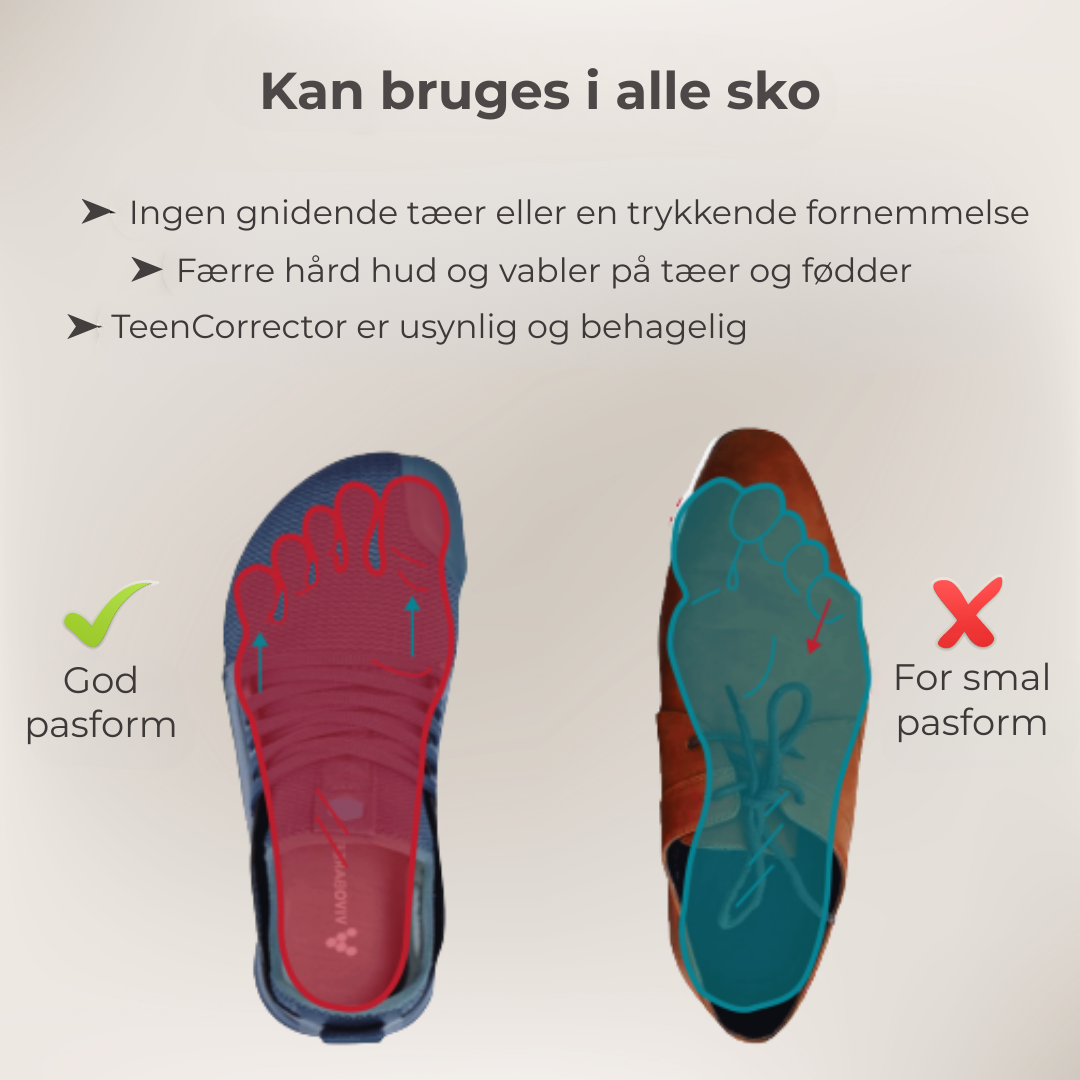 FlexiToe® | Skånsom tåjustering for daglig lindring