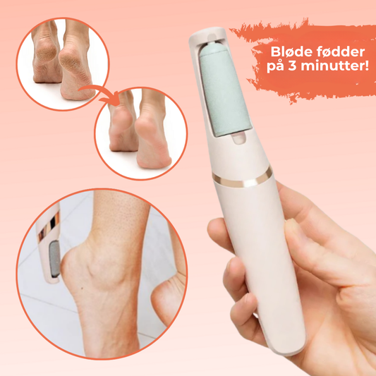 SilkSteps® | Øjeblikkelig hård hudfjerner til babybløde fødder