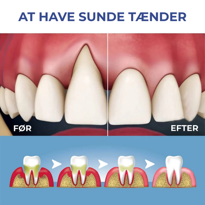 BlidGum® | Revitaliserer tilbagetrukket tandkød og hvidner gule tænder på kun 3 dage