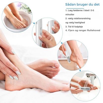 SilkSteps® | Elektrisk Eeltfjerner for Glatte, Bløde Fødder